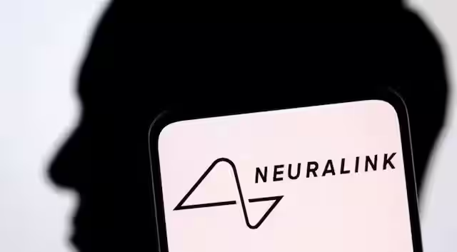 Human trial of Elon Musk's Neuralink hits snag as brain chip begins to detach